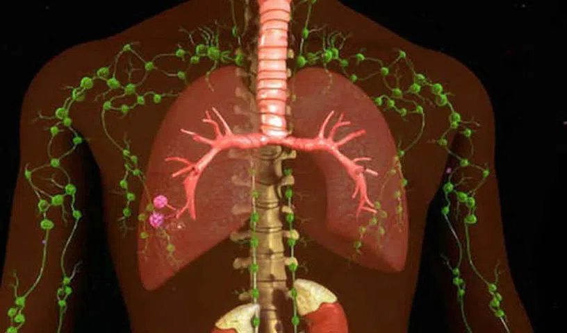 lymphatic-system_V_jpg--816x480-4g